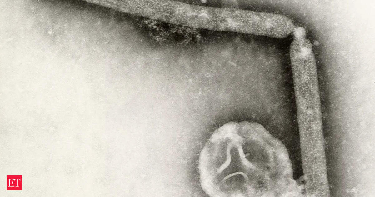 Rare H5N5 Bird Flu Claims Life of Washington Resident: What You Need to Know