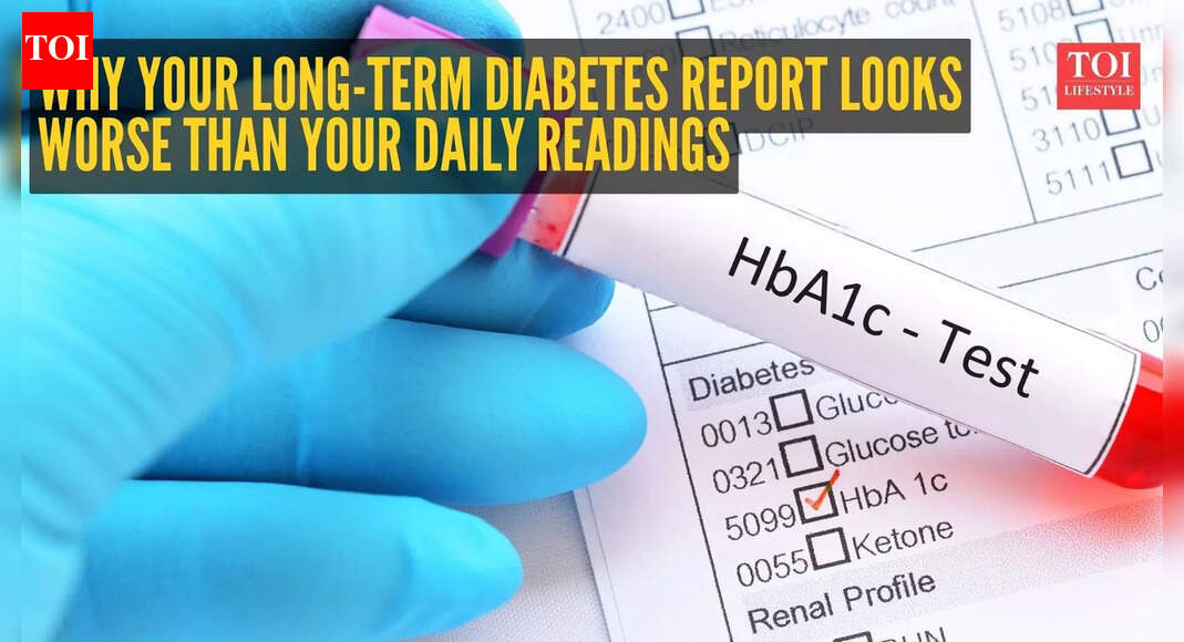 Understanding Discrepancies: High HbA1c Amid Normal Fasting Sugar Levels