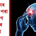 Effective Ways to Find Relief from Migraine Problems Today!