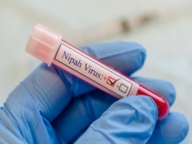 Nipah Virus Alert in Bengal: Essential Precautions for Your Safety
