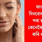 ফাগুনৰ ধূলিৰ সময়ত ছাল সুৰক্ষাৰ ৭ জৰুৰী আৰু কার্যকৰী উপায়