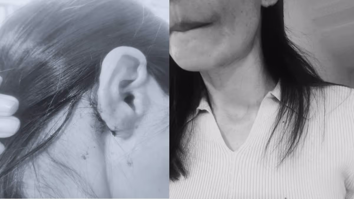 Manipur Woman Assaulted in South Delhi Park — Racism Outrage