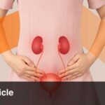 Astonishing Natural History of a Giant Bladder Stone: Key Insights