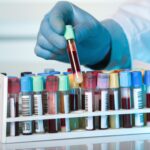 Breakthrough Test Rapidly Detects Active, Infectious Tuberculosis