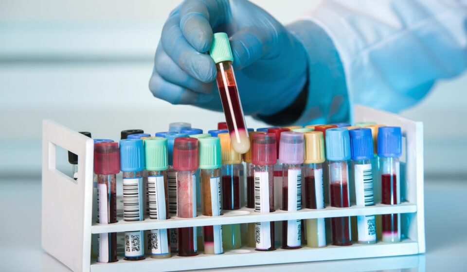 Breakthrough Test Rapidly Detects Active, Infectious Tuberculosis