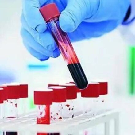 Breakthrough Blood Test Detects Lung Cancer 5 Years Early