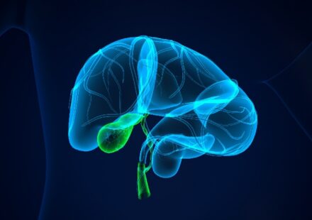 Could cfDNA Revolutionize Gallbladder Cancer Diagnosis?