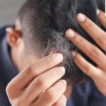 PM2.5 Danger: Experts Warn Air Pollution May Cause Hair Loss