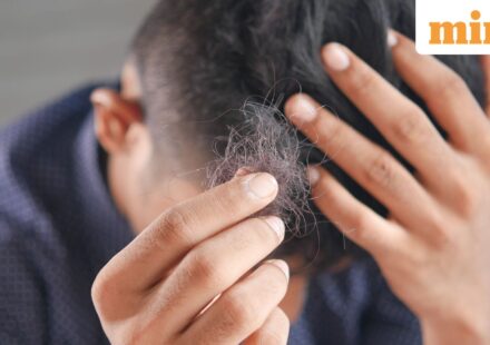 PM2.5 Danger: Experts Warn Air Pollution May Cause Hair Loss