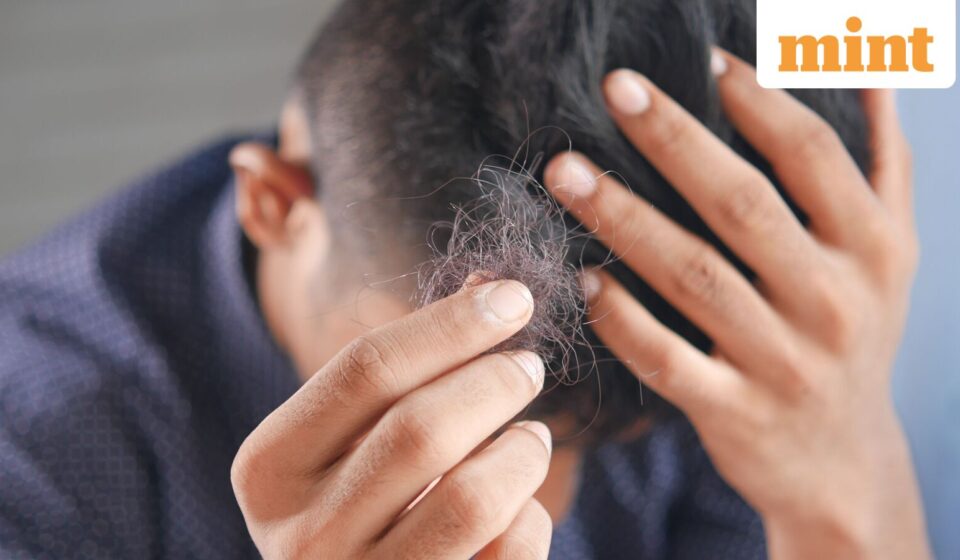 PM2.5 Danger: Experts Warn Air Pollution May Cause Hair Loss