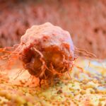 Optimize Cancer Treatment Timing: Circadian Oncology Insights