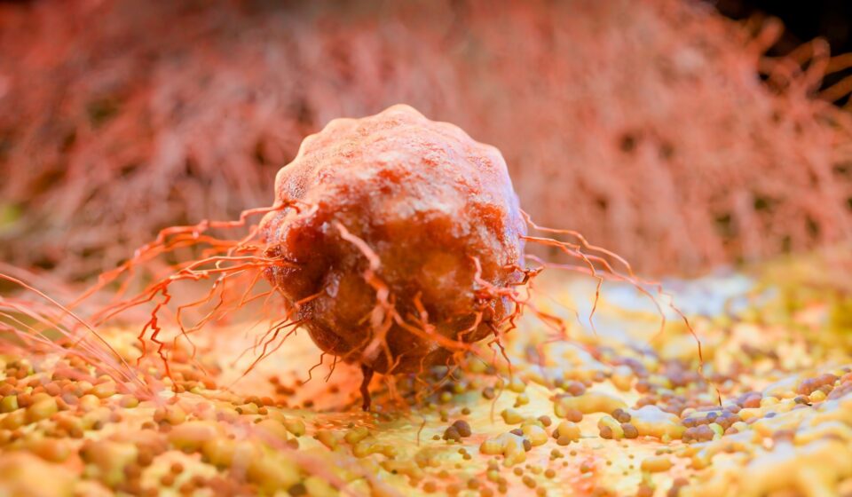 Optimize Cancer Treatment Timing: Circadian Oncology Insights