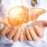 Immunotherapy Downstaging: A Breakthrough for Liver Transplant in HCC